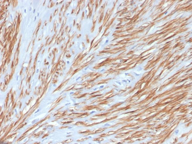 Calponin-1 Antibody in Immunohistochemistry (Paraffin) (IHC (P))