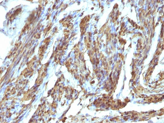 Calponin-1 (Smooth Muscle Marker) Antibody in Immunohistochemistry (Paraffin) (IHC (P))