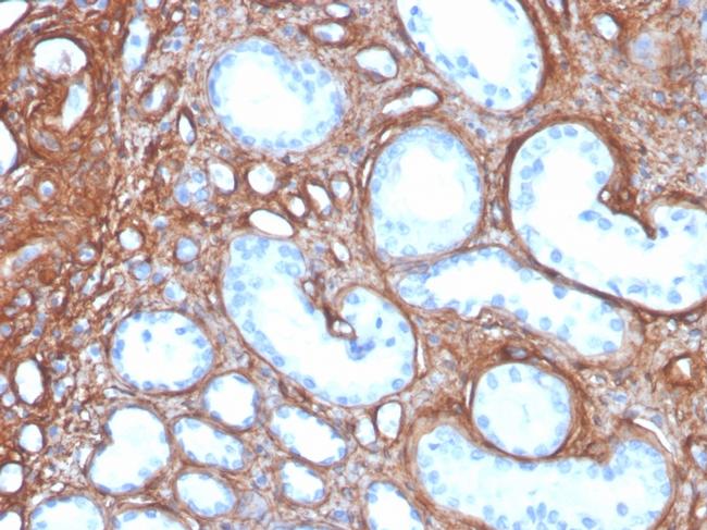 Collagen IV Antibody in Immunohistochemistry (Paraffin) (IHC (P))