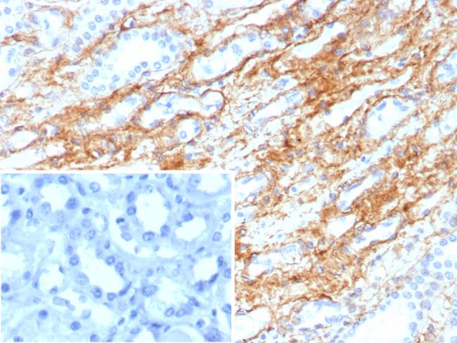 Collagen IV Antibody in Immunohistochemistry (Paraffin) (IHC (P))