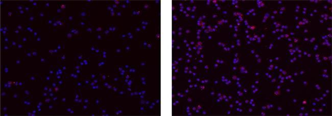 Mouse IgG1 kappa Isotype Control in Immunocytochemistry (ICC/IF)