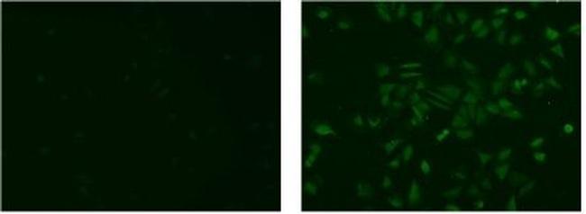 Rat IgG (H+L) Secondary Antibody in Immunocytochemistry (ICC/IF)