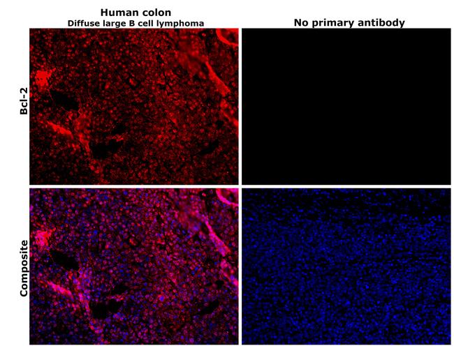 Bcl-2 Antibody in Immunohistochemistry (Paraffin) (IHC (P))