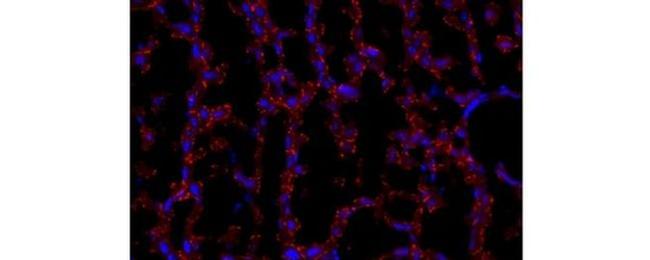 Connexin 32 Antibody in Immunohistochemistry (Frozen) (IHC (F))