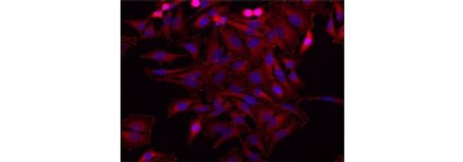 Vinculin Antibody in Immunocytochemistry (ICC/IF)