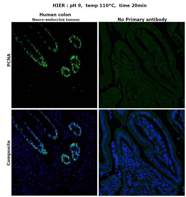 PCNA Antibody in Immunohistochemistry (Paraffin) (IHC (P))