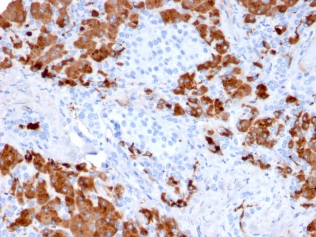 Carboxypeptidase A1/CPA1 Antibody in Immunohistochemistry (Paraffin) (IHC (P))