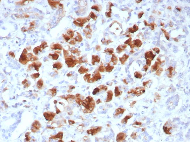 Carboxypeptidase A1/CPA1 (Pancreatic Cancer Marker) Antibody in Immunohistochemistry (Paraffin) (IHC (P))