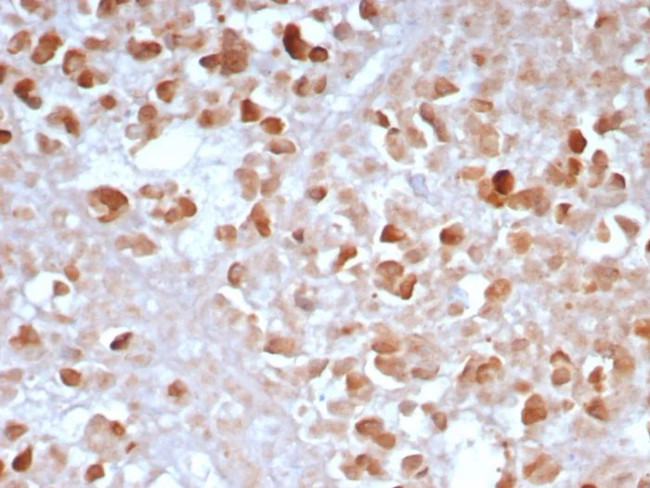 Carboxypeptidase A1/CPA1 (Pancreatic Cancer Marker) Antibody in Immunohistochemistry (Paraffin) (IHC (P))