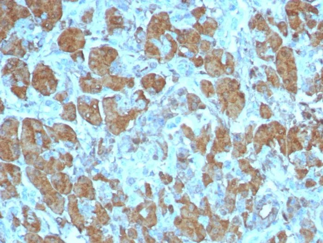 Carboxypeptidase A1/CPA1 (Pancreatic Cancer Marker) Antibody in Immunohistochemistry (Paraffin) (IHC (P))