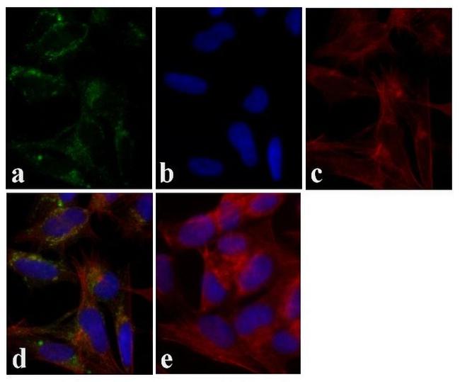 Tau Antibody in Immunocytochemistry (ICC/IF)