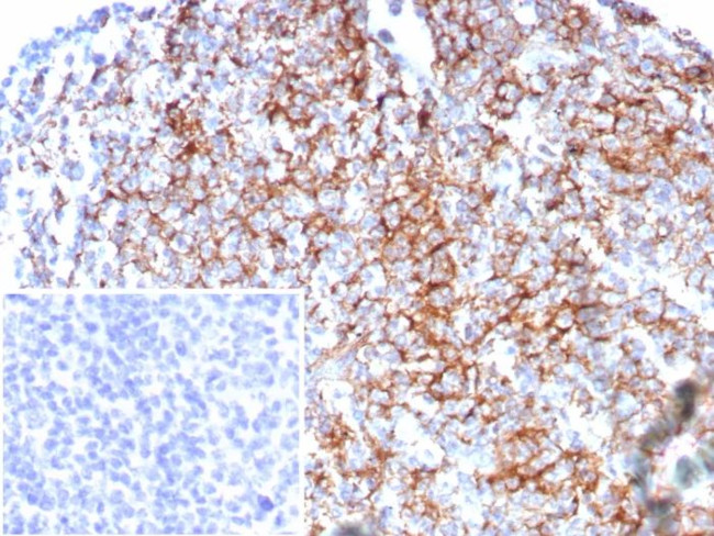 CD35/CR1 (Follicular Dendritic Cell Marker) Antibody in Immunohistochemistry (Paraffin) (IHC (P))