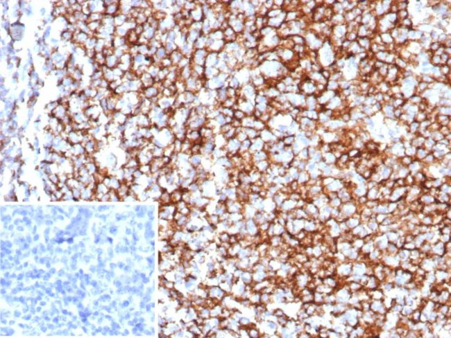 CD35/CR1 (Follicular Dendritic Cell Marker) Antibody in Immunohistochemistry (Paraffin) (IHC (P))