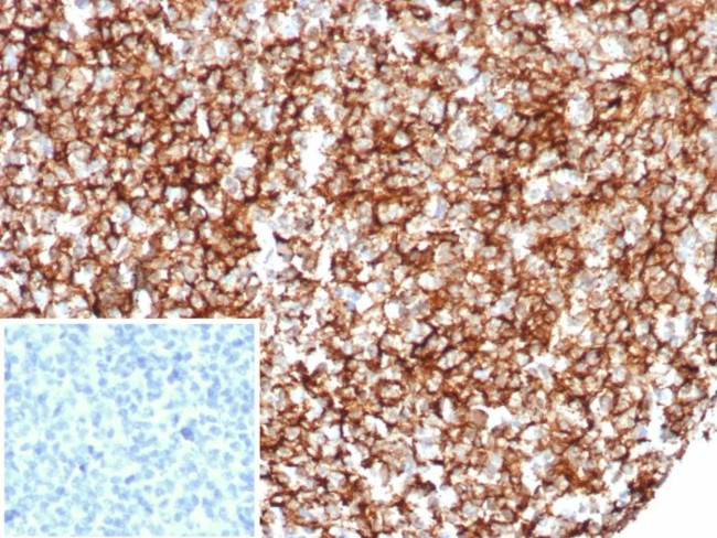 CD35/CR1 (Follicular Dendritic Cell Marker) Antibody in Immunohistochemistry (Paraffin) (IHC (P))