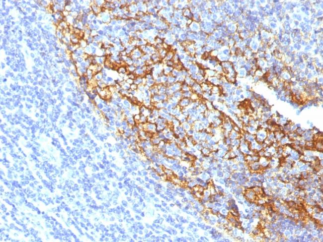 CD35/CR1 (Follicular Dendritic Cell Marker) Antibody in Immunohistochemistry (Paraffin) (IHC (P))