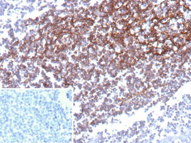 CD35/CR1 (Follicular Dendritic Cell Marker) Antibody in Immunohistochemistry (Paraffin) (IHC (P))