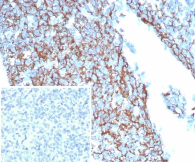 CD35/CR1 (Follicular Dendritic Cell Marker) Antibody in Immunohistochemistry (Paraffin) (IHC (P))