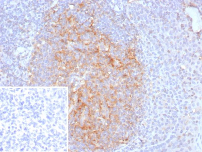 CD35/CR1 (Follicular Dendritic Cell Marker) Antibody in Immunohistochemistry (Paraffin) (IHC (P))