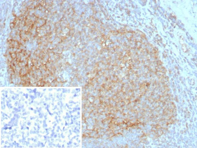 CD35/CR1 (Follicular Dendritic Cell Marker) Antibody in Immunohistochemistry (Paraffin) (IHC (P))