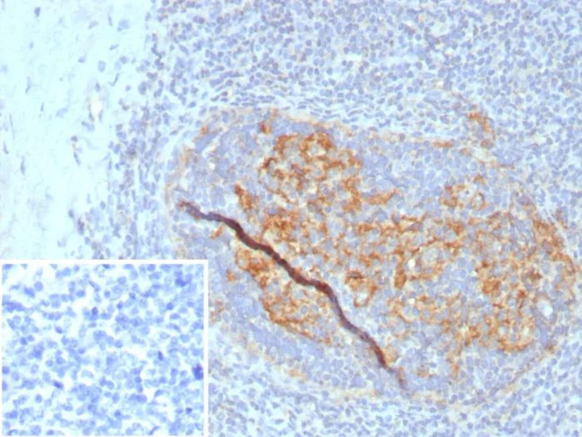 CD35/CR1 (Follicular Dendritic Cell Marker) Antibody in Immunohistochemistry (Paraffin) (IHC (P))