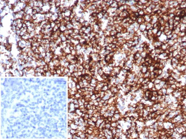 CD35/CR1 (Follicular Dendritic Cell Marker) Antibody in Immunohistochemistry (Paraffin) (IHC (P))