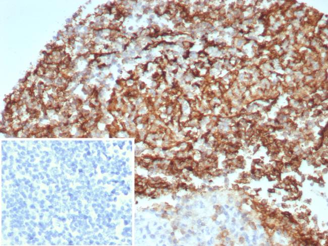 CD35/CR1 (Follicular Dendritic Cell Marker) Antibody in Immunohistochemistry (Paraffin) (IHC (P))