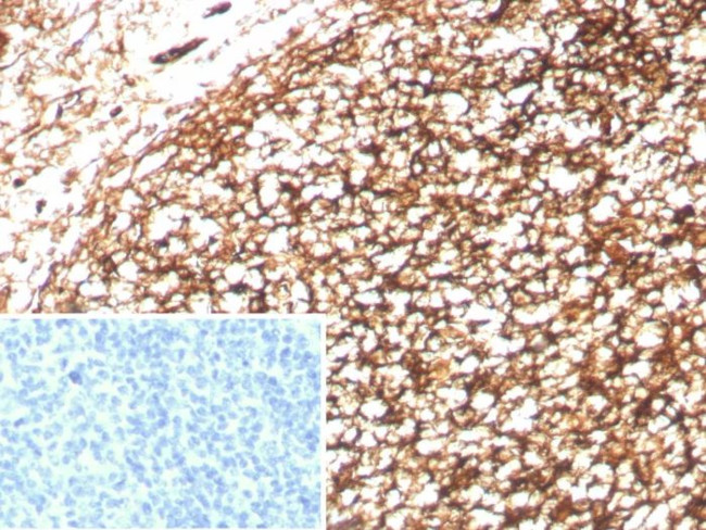 CD35/CR1 (Follicular Dendritic Cell Marker) Antibody in Immunohistochemistry (Paraffin) (IHC (P))