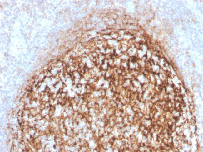 CD35/CR1 (Follicular Dendritic Cell Marker) Antibody in Immunohistochemistry (Paraffin) (IHC (P))