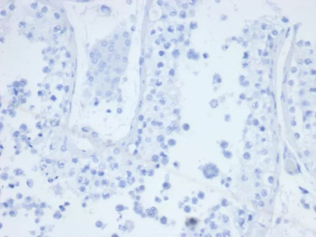 CD21 (Mature B-Cell and Follicular Dendritic Cell Marker) Antibody in Immunohistochemistry (Paraffin) (IHC (P))