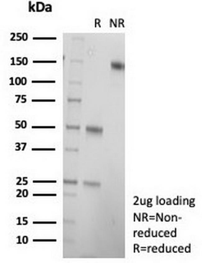 CD21 (Mature B-Cell and Follicular Dendritic Cell Marker) Antibody in Immunohistochemistry (Paraffin) (IHC (P))