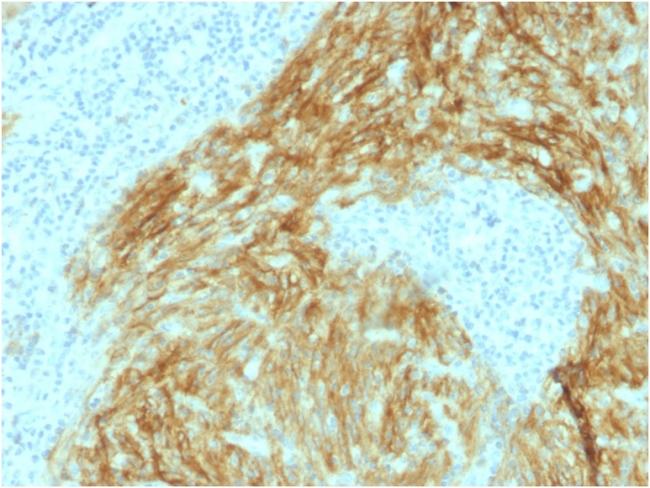 CD21 (Mature B-Cell and Follicular Dendritic Cell Marker) Antibody in Immunohistochemistry (Paraffin) (IHC (P))