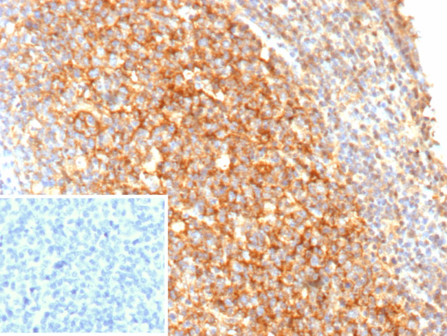 CD21 (Mature B-Cell and Follicular Dendritic Cell Marker) Antibody in Immunohistochemistry (Paraffin) (IHC (P))