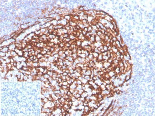 CD21 (Mature B-Cell and Follicular Dendritic Cell Marker) Antibody in Immunohistochemistry (Paraffin) (IHC (P))