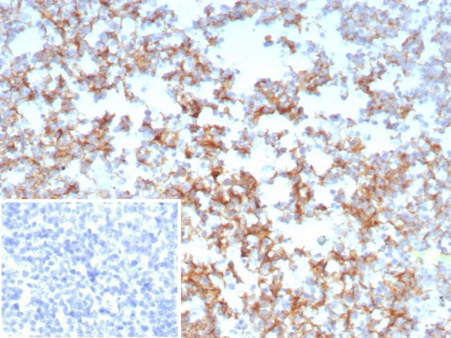 CD21 (Mature B-Cell and Follicular Dendritic Cell Marker) Antibody in Immunohistochemistry (Paraffin) (IHC (P))