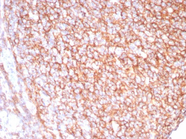 CD21 (Mature B-Cell and Follicular Dendritic Cell Marker) Antibody in Immunohistochemistry (Paraffin) (IHC (P))