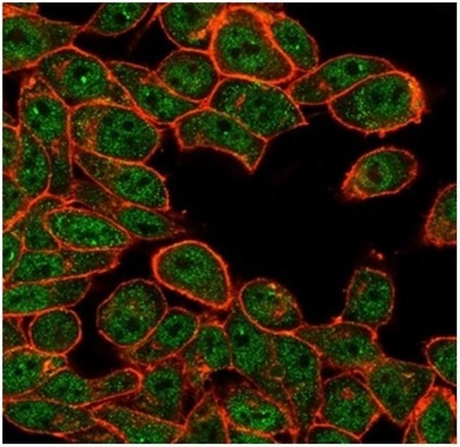 ATF2 Antibody in Immunocytochemistry (ICC/IF)