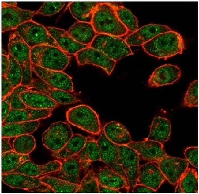 ATF2 Antibody in Immunocytochemistry (ICC/IF)