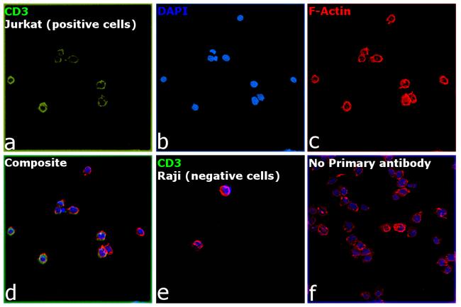 CD3 Antibody in Immunocytochemistry (ICC/IF)