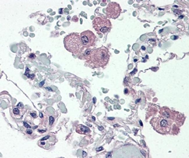 CD14 Antibody in Immunohistochemistry (Paraffin) (IHC (P))