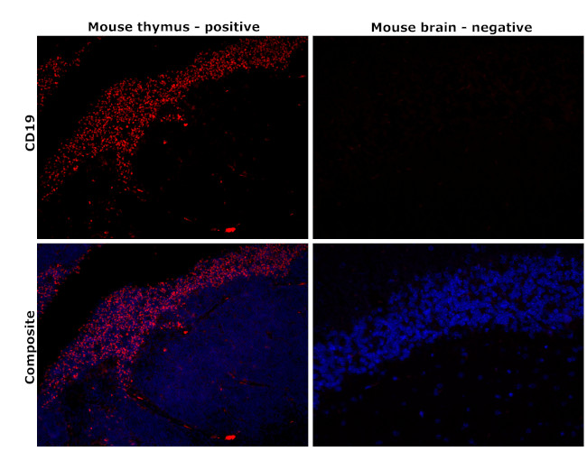 CD19 Antibody in Immunohistochemistry (Paraffin) (IHC (P))