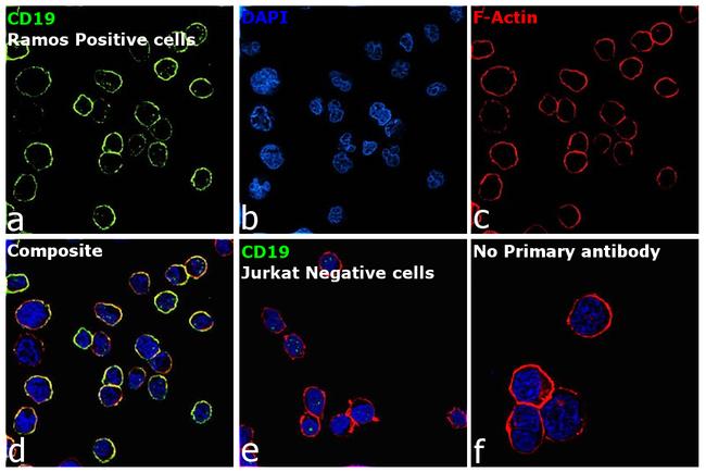 CD19 Antibody in Immunocytochemistry (ICC/IF)