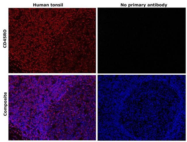 CD45RO Antibody in Immunohistochemistry (Paraffin) (IHC (P))