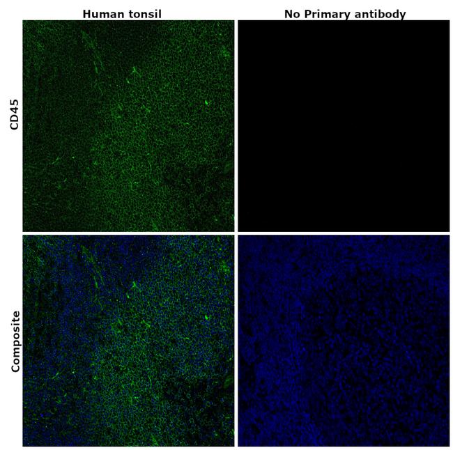 CD45 Antibody in Immunohistochemistry (Paraffin) (IHC (P))