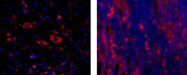 CD141 Antibody in Immunocytochemistry (ICC/IF)