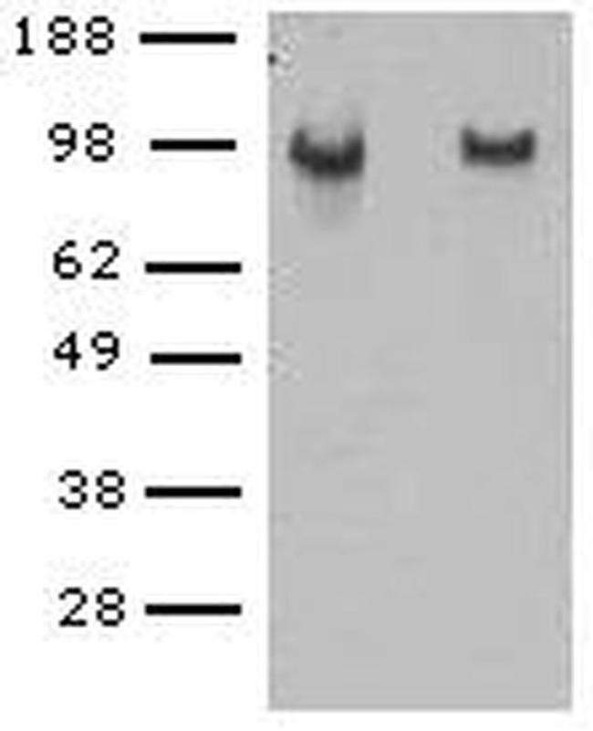 CD144 (VE-cadherin) Antibody in Western Blot (WB)