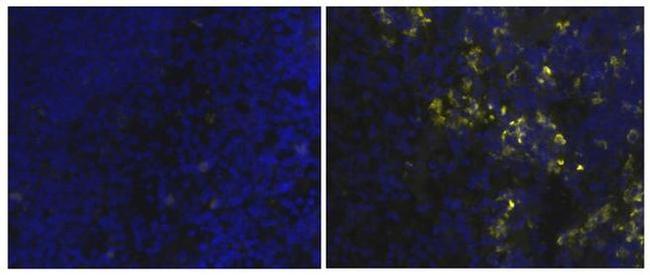 CD163 Antibody in Immunohistochemistry (Frozen) (IHC (F))