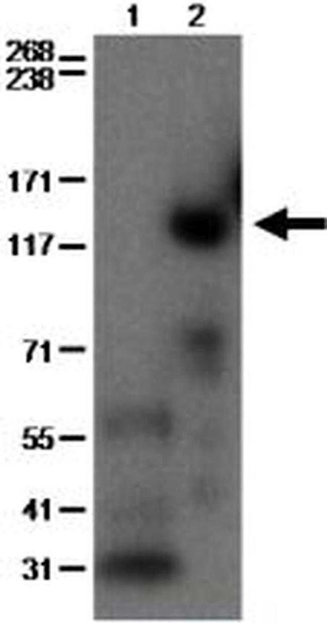 PDE3B Antibody in Western Blot (WB)