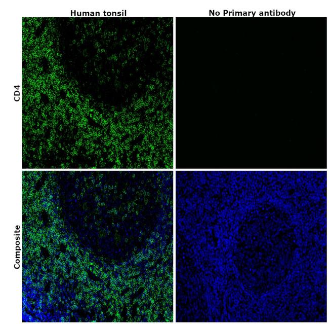 CD4 Antibody in Immunohistochemistry (Paraffin) (IHC (P))