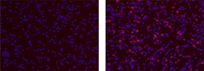 Mouse IgG1 kappa Isotype Control in Immunocytochemistry (ICC/IF)