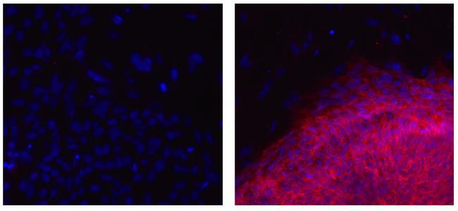 Mouse IgG2a kappa Isotype Control in Immunocytochemistry (ICC/IF)